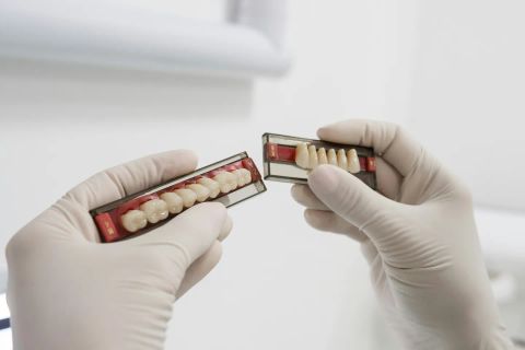 Keramik oder Metall? Welche Brackets zu dir passen
